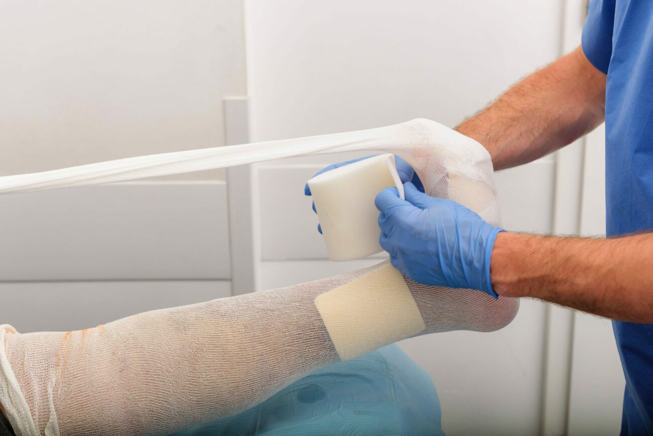 doctor wrapping a foot with a cast